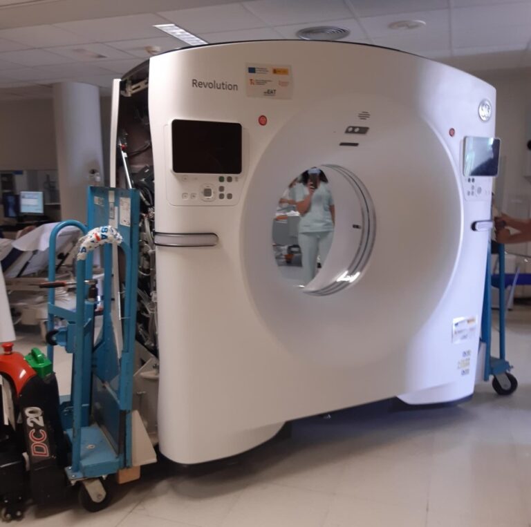El Hospital de Torrevieja incorpora un nuevo TAC de última generación